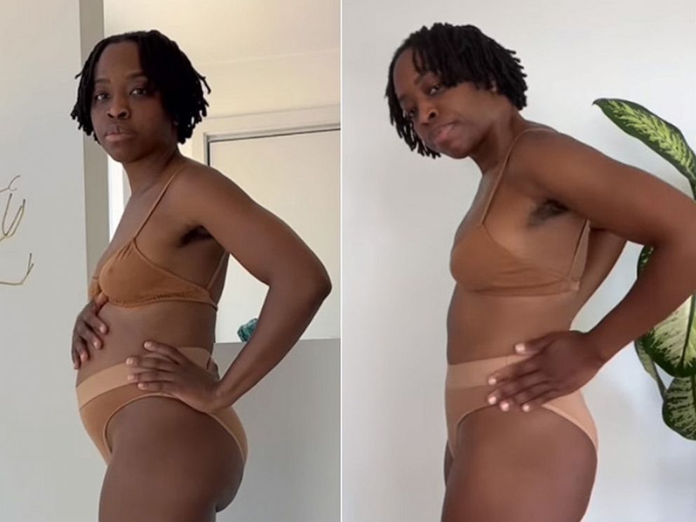 Root Cause vs Symptom Control