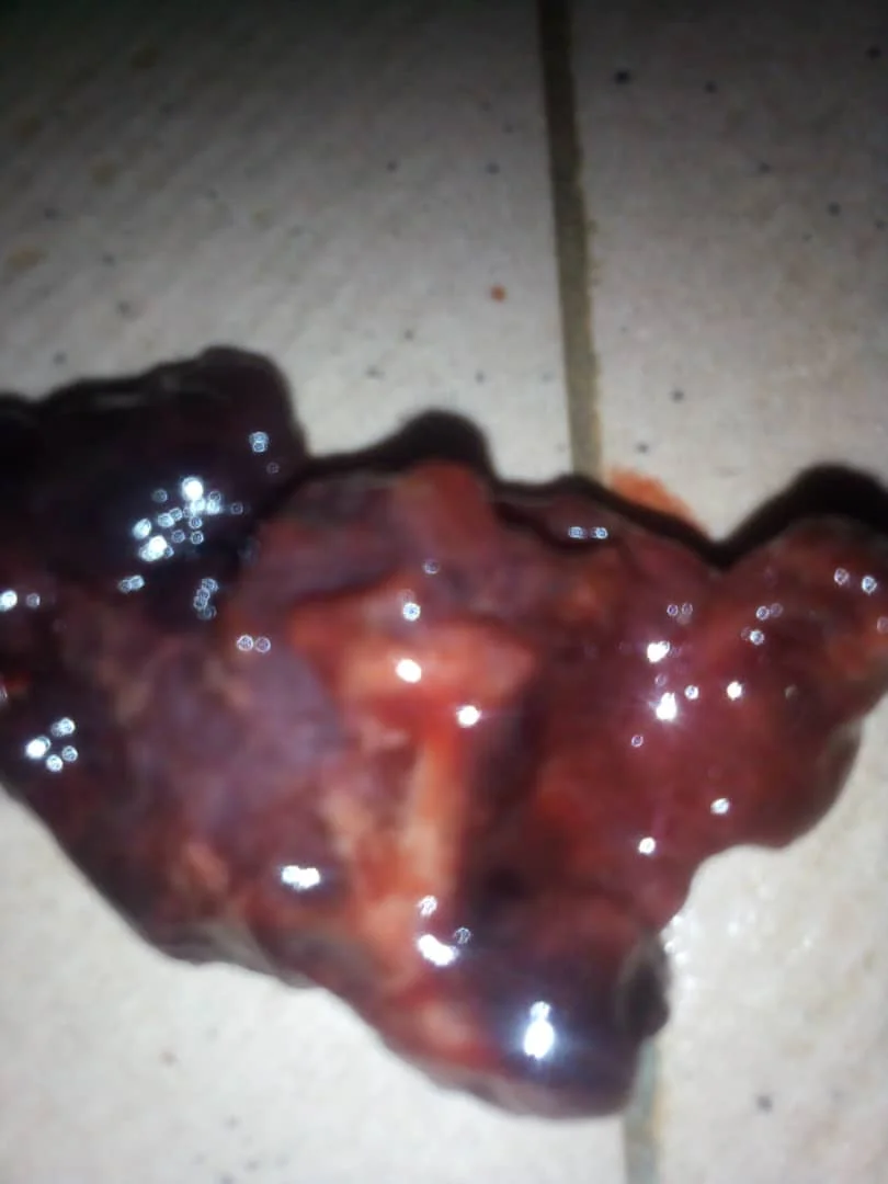 Before and after treatment 2